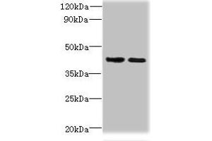 Western blot All lanes: CHID1 antibody at 0. (CHID1 抗体  (AA 20-393))