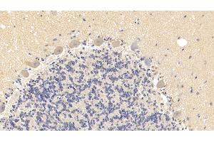Immunohistochemistry (IHC) image for anti-Sema Domain, Seven Thrombospondin Repeats (Type 1 and Type 1-Like), Transmembrane Domain (TM) and Short Cytoplasmic Domain, (Semaphorin) 5B (SEMA5B) (AA 350-602) antibody (ABIN7438508)