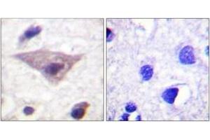 Immunohistochemistry analysis of paraffin-embedded human brain, using Synuclein (Phospho-Ser129) Antibody. (Synuclein 抗体  (pSer129))