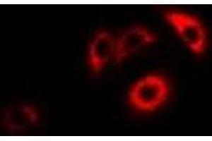 Immunofluorescent analysis of ERp46 staining in HepG2 cells. (TXNDC5 抗体)