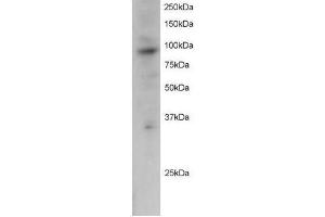 Image no. 1 for anti-PML-RARA Regulated Adaptor Molecule 1 (PRAM1) (C-Term) antibody (ABIN374107) (PRAM1 抗体  (C-Term))