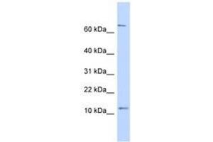 Image no. 1 for anti-Nuclear Receptor 2C2-Associated Protein (NR2C2AP) (N-Term) antibody (ABIN6741243) (NR2C2AP 抗体  (N-Term))