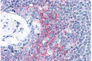 Human Spleen (formalin-fixed, paraffin-embedded) stained with ICAM1 antibody ABIN337366 at 10 ug/ml followed by biotinylated anti-mouse IgG secondary antibody ABIN481714, alkaline phosphatase-streptavidin and chromogen. (ICAM1 抗体)