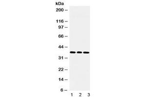 Western blot testing of 1) rat brain, 2) mouse NIH 3T3 and 3) human U-2 OS lysate with LDHB antibody at 0. (LDHB 抗体)