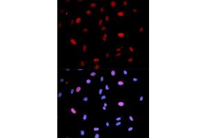 Immunofluorescence (IF) image for anti-Mitogen-Activated Protein Kinase Kinase 6 (MAP2K6) (pSer207) antibody (ABIN1870360) (MAP2K6 抗体  (pSer207))