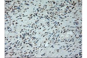 Immunohistochemical staining of paraffin-embedded lung tissue using anti-L1CAMmouse monoclonal antibody. (L1CAM 抗体)