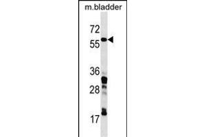 CORO1C Antibody (C-term) (ABIN1537223 and ABIN2850131) western blot analysis in mouse bladder tissue lysates (35 μg/lane). (CORO1C 抗体  (C-Term))