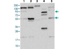 Western blot analysis of WDR44 polyclonal antibody . (WDR44 抗体)