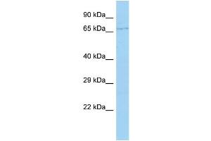 Host: Rabbit Target Name: CYP4F22 Sample Type: 721_B Whole Cell lysates Antibody Dilution: 1. (CYP4F22 抗体  (Middle Region))