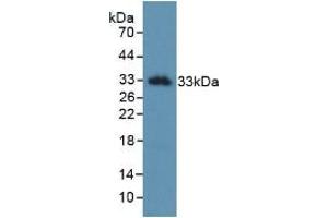 Detection of Recombinant KLK2, Human using Monoclonal Antibody to Kallikrein 2 (KLK2) (Kallikrein 2 抗体  (AA 19-261))