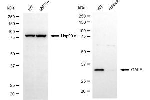 Western blotting analysis using GALE antibody (ABIN7800765). (GALE 抗体)