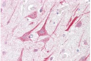 Immunohistochemistry (IHC) image for anti-Zinc Finger, MYM-Type 2 (ZMYM2) (C-Term) antibody (ABIN959704)