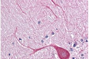 Human Brain, Cerebellum: Formalin-Fixed, Paraffin-Embedded (FFPE) (TLR3 抗体  (AA 514-657))