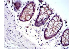 Immunohistochemical analysis of paraffin-embedded rectum tissues using JUP mouse mAb with DAB staining.