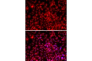 Immunofluorescence (IF) image for anti-Interleukin Enhancer Binding Factor 2, 45kDa (ILF2) antibody (ABIN1980249) (ILF2 抗体)