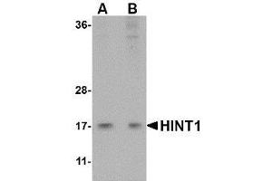 Western blot analysis of HINT1 in Jurkat lysate with AP30394PU-N HINT1 antibody at (A) 1 and (B) 2 μg/ml. (HINT1 抗体  (Center))