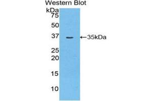 Western Blotting (WB) image for anti-Myosin ID (MYO1D) (AA 512-788) antibody (ABIN1859951) (Myosin ID 抗体  (AA 512-788))