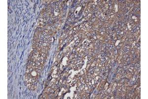 Immunohistochemistry (IHC) image for anti-Crystallin, alpha A (CRYAA) antibody (ABIN1498754)