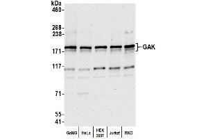 Western Blotting (WB) image for anti-Cyclin G Associated Kinase (GAK) (AA 675-725) antibody (ABIN7453089) (GAK 抗体  (AA 675-725))