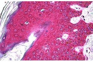 Human Skin: Formalin-Fixed, Paraffin-Embedded (FFPE) (FGFR2 抗体  (AA 621-724))