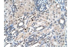 PIGV antibody was used for immunohistochemistry at a concentration of 4-8 ug/ml to stain Epithelial cells of renal tubule (arrows) in Human Kidney. (PIGV 抗体  (N-Term))
