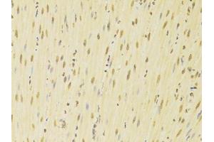 Immunohistochemistry of paraffin-embedded mouse heart using HNRNPK Antibody.