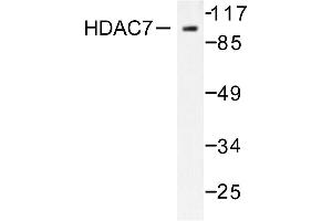 Image no. 1 for anti-Histone Deacetylase 7 (HDAC7) antibody (ABIN265459) (HDAC7 抗体)
