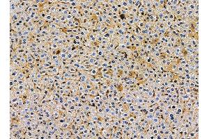 ABIN7095387 and ABIN7099444 at 1/100 staining mouse liver tissue by IHC-P. (Lunapark 抗体)