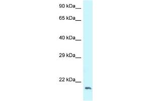 WB Suggested Anti-DCTN3 Antibody Titration: 1. (DCTN3 抗体  (C-Term))