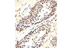 Immunohistochemical analysis of paraffin-embedded H. (AKT 1/2/3 抗体  (AA 278-312))