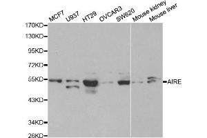 Western blot analysis of extracts of various cell lines, using AIRE antibody. (AIRE 抗体)