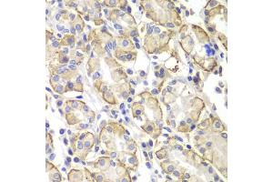 Immunohistochemistry of paraffin-embedded human stomach using Lyn antibody (ABIN4904272) at dilution of 1:100 (40x lens). (LYN 抗体)