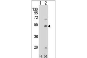 Western blot analysis of FDFT1 (arrow) using rabbit polyclonal FDFT1 Antibody  (ABIN389052 and ABIN2839261). (FDFT1 抗体  (AA 140-170))
