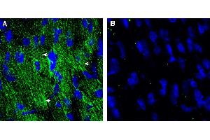 Expression of CaVβ2 in mouse heart.
