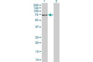 Western Blotting (WB) image for anti-Neurotrophic tyrosine Kinase, Receptor, Type 3 (NTRK3) (AA 1-612) antibody (ABIN518452)