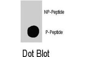 Dot blot analysis of TSC2 (phospho S939) polyclonal antibody  on nitrocellulose membrane.