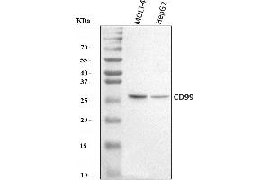 Western blot analysis of CD99 using anti-CD99 antibody (ABIN7602866).