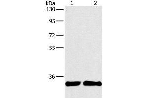 Western Blot analysis of A431 and 231 cell using ARTN Polyclonal Antibody at dilution of 1:350 (ARTN 抗体)