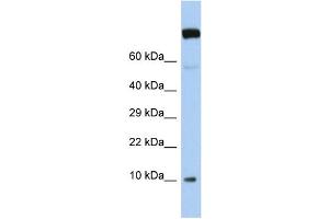 Host:  Rabbit  Target Name:  WBP5  Sample Type:  Jurkat Whole Cell lysates  Antibody Dilution:  1. (WW Domain Binding Protein 5 (WBP5) (N-Term) 抗体)