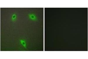 Immunofluorescence analysis of A549 cells, using KLHL3 Antibody. (KLHL3 抗体  (AA 10-59))