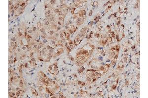 Immunohistochemistry (IHC) image for anti-Signal Transducer and Activator of Transcription 3 (Acute-Phase Response Factor) (STAT3) (C-Term) antibody (ABIN6265317)