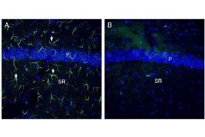 Expression of Otopetrin-1 in mouse hippocampus. (Otopetrin 1 抗体  (4th Cytoplasmic Loop))