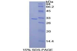 SDS-PAGE analysis of Rat CD2 Associated Protein. (CD2AP 蛋白)