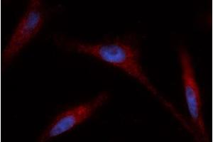 Immunofluorescence (IF) image for anti-Glutaredoxin 1 (GRX1) (AA 1-106) antibody (PE) (ABIN5565554) (Glutaredoxin 1 抗体  (AA 1-106) (PE))