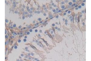 Detection of GSTA4 in Rat Testis Tissue using Polyclonal Antibody to Glutathione S Transferase A4 (GSTA4) (GSTA4 抗体  (AA 2-222))