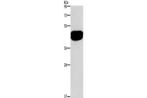 Western Blotting (WB) image for anti-serologically Defined Colon Cancer Antigen 3 (SDCCAG3) antibody (ABIN2421479)