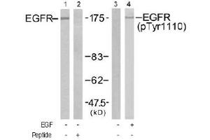 Image no. 2 for anti-Epidermal Growth Factor Receptor (EGFR) (Tyr1110) antibody (ABIN197517) (EGFR 抗体  (Tyr1110))