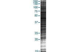 TTC30B transfected lysate. (TTC30B 293T Cell Transient Overexpression Lysate(Denatured))
