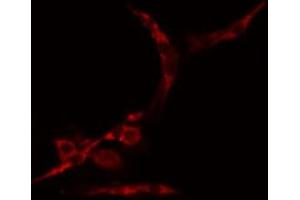 ABIN6274991 staining Hela cells by IF/ICC. (CEP70 抗体  (Internal Region))
