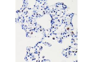 Immunohistochemistry of paraffin-embedded rat lung using [KO Validated] Cyclin D1 Rabbit mAb (ABIN7266561) at dilution of 1:100 (40x lens). (Cyclin D1 抗体)